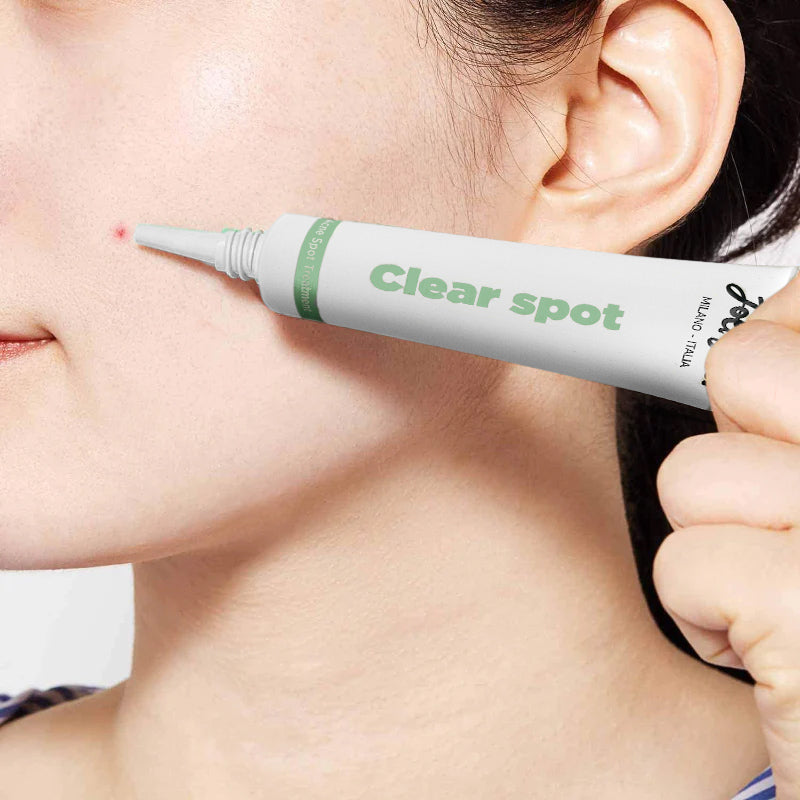 Joli Joli Clear Spot - Acne Spot Treatment